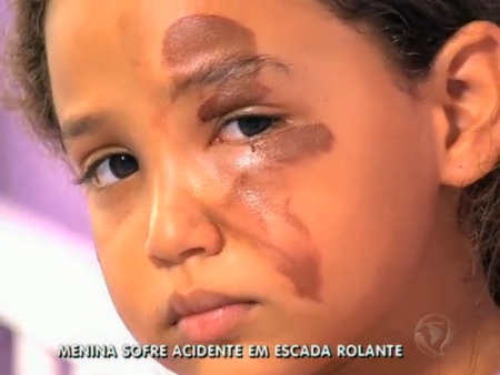 Menina presa escada rolante